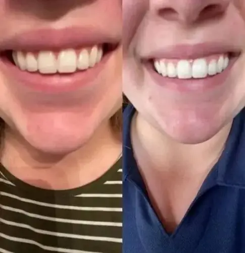 Small Purple Bottle Cross border Purple Bright White Toothpaste for Cleaning Oral Teeth, Whitening Teeth, Color Mixing and Care of Gums Bottle Press photo review