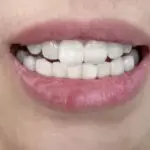 Ginger Antibacterial Toothpaste, Gum Stain, Tooth Freshness, Oral Care, Deodorization, Tooth Fixation, and Brightening photo review