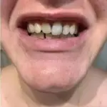 Small Purple Bottle Cross border Purple Bright White Toothpaste for Cleaning Oral Teeth, Whitening Teeth, Color Mixing and Care of Gums Bottle Press photo review