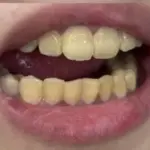 Bee Venom Facial Care Cream Mild, Moisturizing, Delicate, Tender and Moisturizing Skin Care Cream face cream photo review